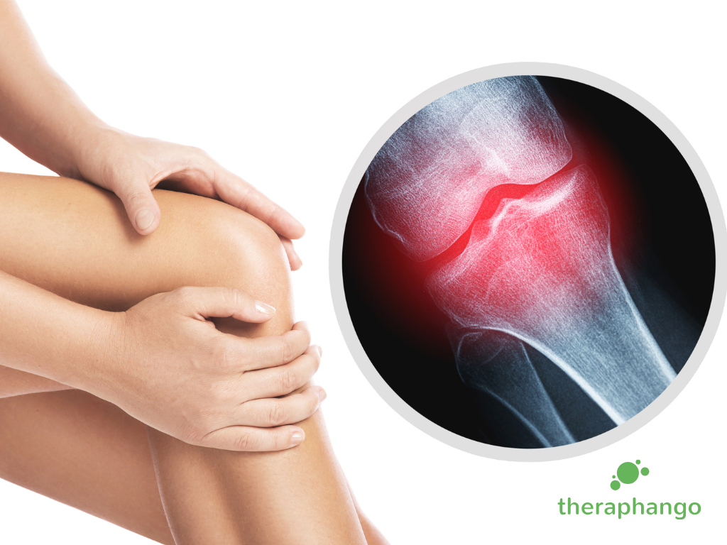 Gelenke, Muskeln, Bandscheiben – wenn Bewegung zur Belastung wird