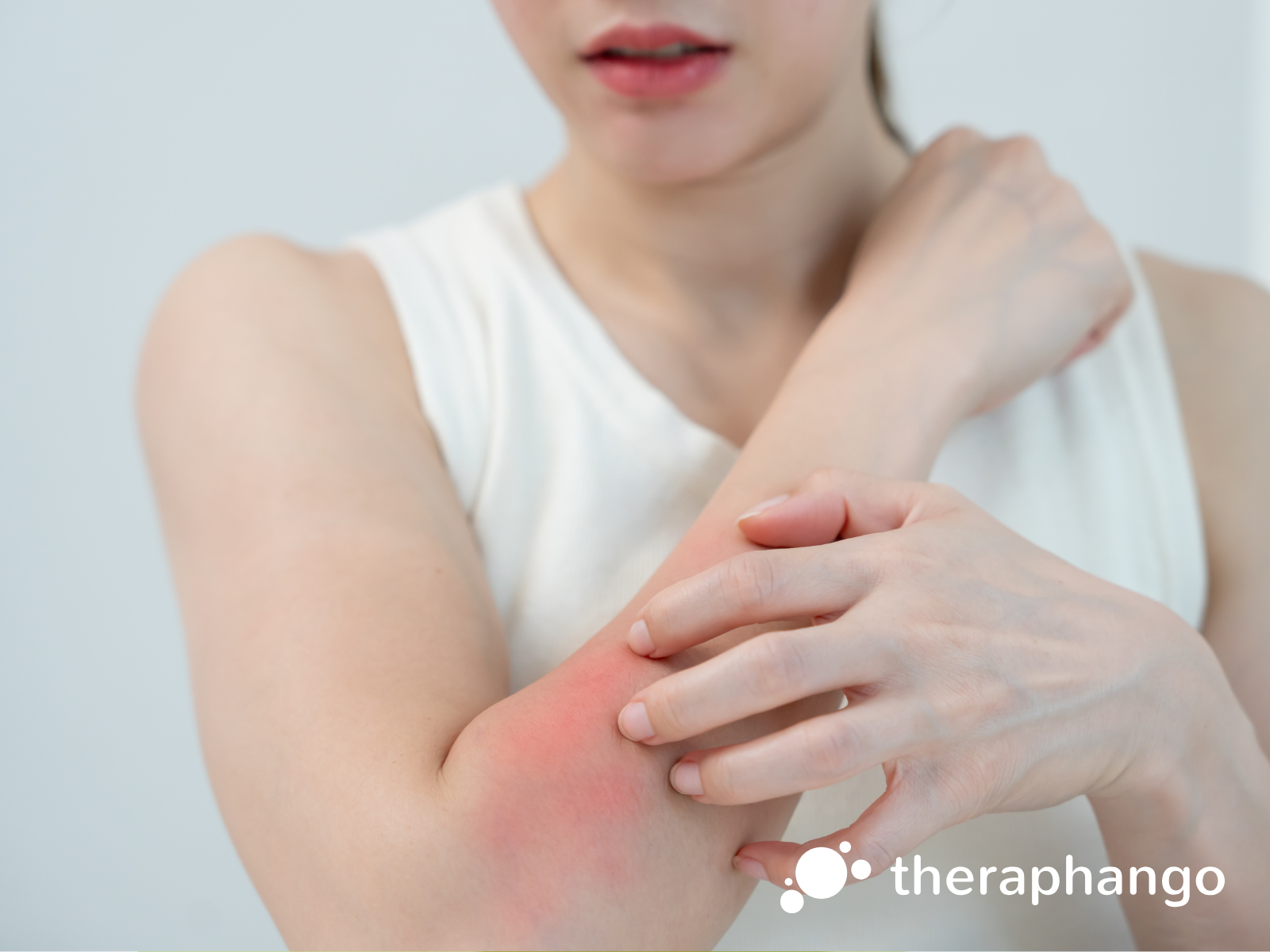 Neurodermitis? Schuppenflechte? Natürliche Hilfe für gereizte Haut!